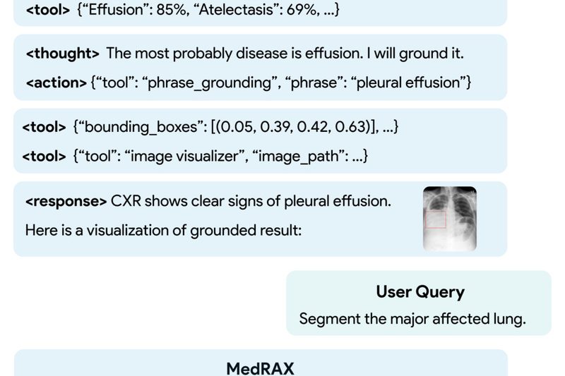 MedRAX: Unified AI Agent for Complex Chest X-ray Reasoning Without Retraining